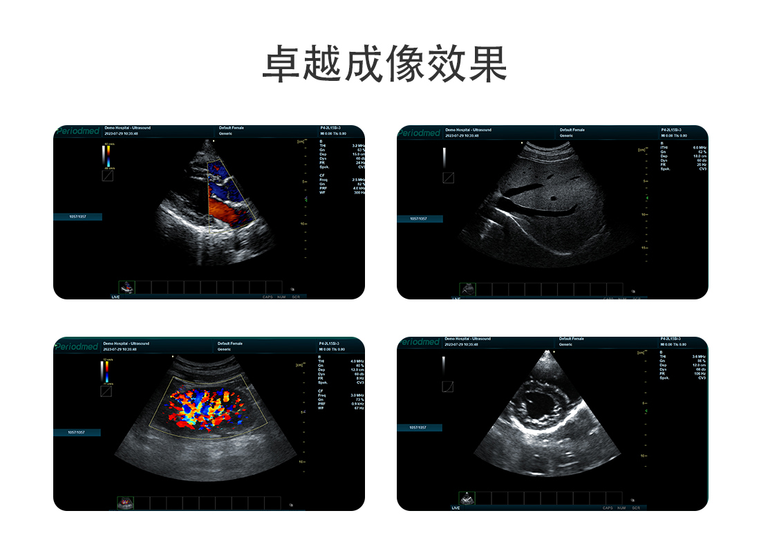 中文网站-PU-VML151A_05