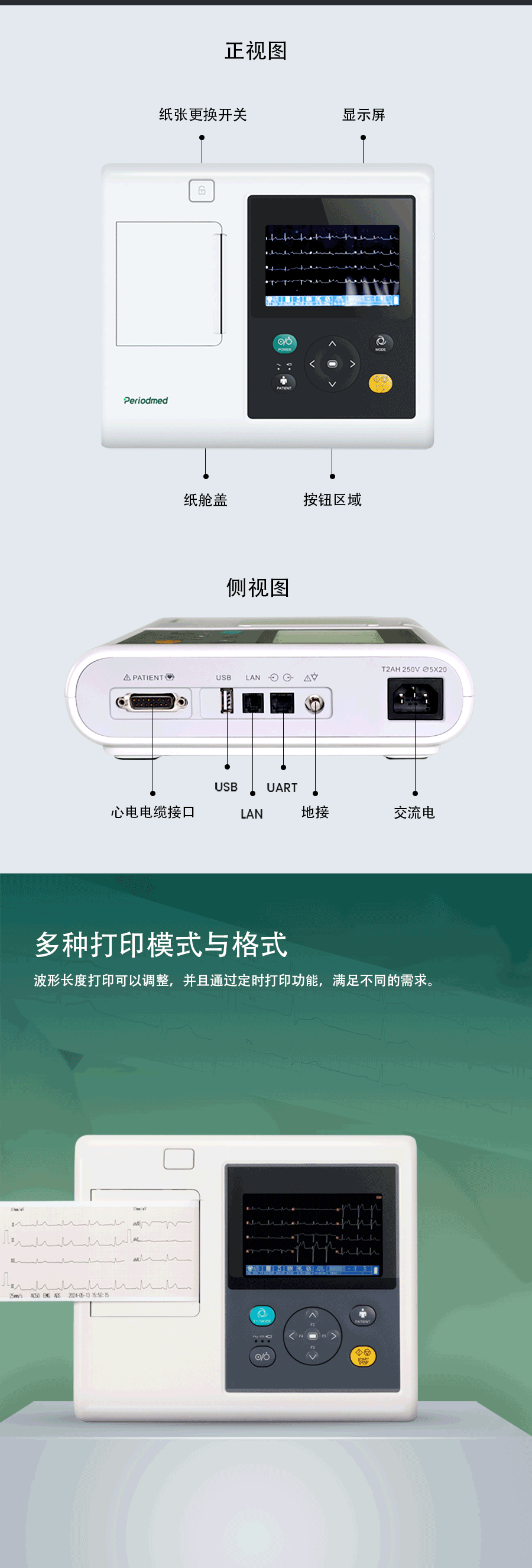 ECG详情改版E3B中文-0612_02