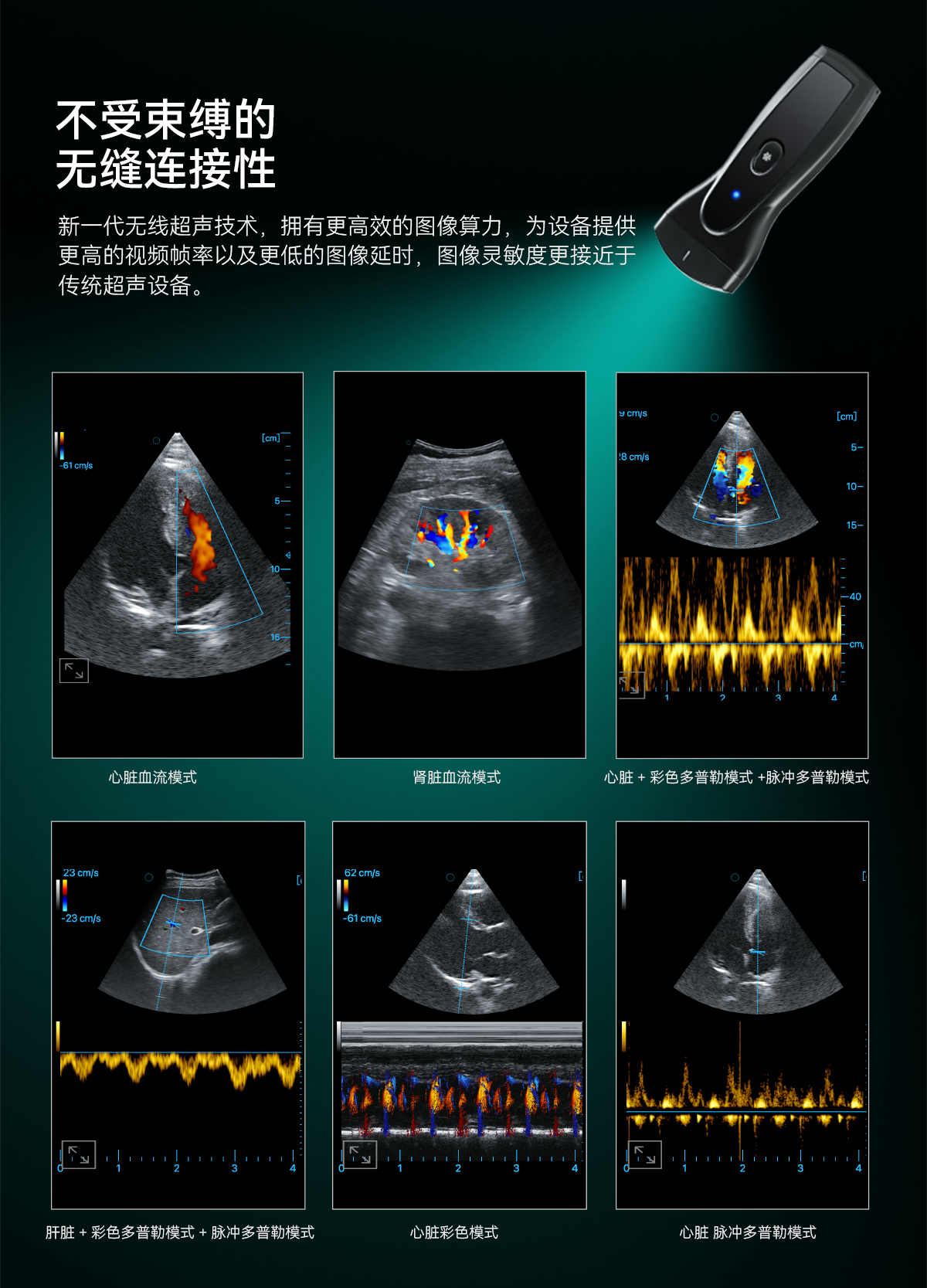 单头掌超中文详情0626_06